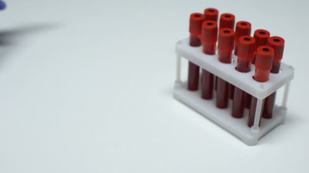 Prueba EV71 positiva, médico mostrando muestra de sangre, investigación de laboratorio, chequeo de salud — Vídeos de Stock