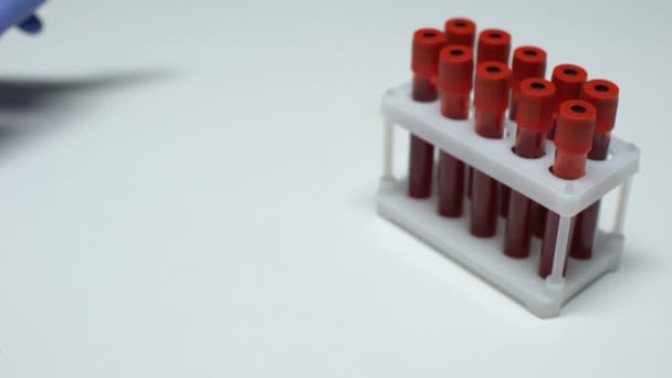 Positivo test E histolytica, medico che mostra il campione di sangue in tubo, controllo dello stato di salute — Video Stock