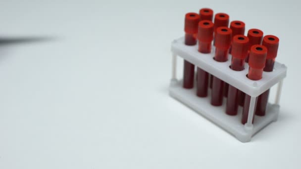 Prueba de enterovirus positiva, médico mostrando muestra de sangre en tubo, chequeo de salud — Vídeo de stock