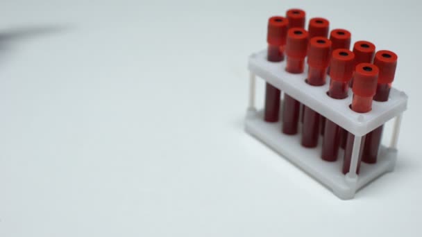 Test positif pour la grippe aviaire, le médecin montre un échantillon de sang, une recherche en laboratoire, un bilan de santé — Video
