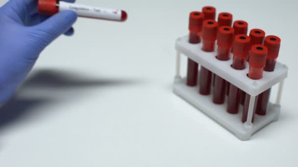 Teste de coagulação positivo, médico mostrando amostra de sangue em tubo, exame de saúde — Vídeo de Stock