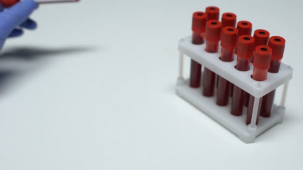 Θετικό τεστ γρίπη Rsv, ο γιατρός δείχνει δείγμα αίματος, εργαστηριακή έρευνα, τσεκ-απ υγείας — Αρχείο Βίντεο