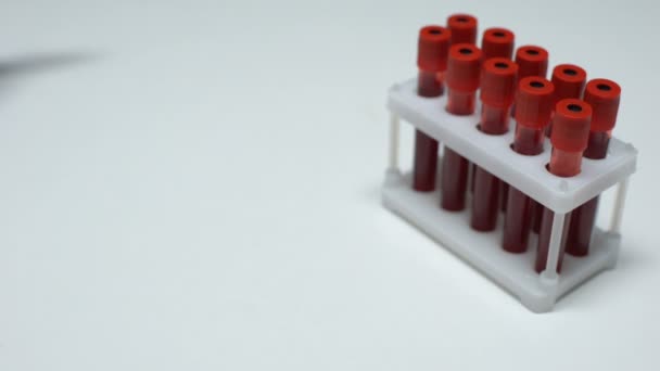 Positieve test op hemofilie, arts weergegeven: bloedmonster in buis, gezondheid checkup — Stockvideo