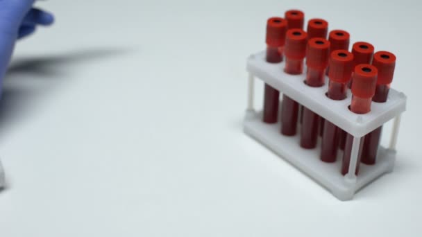 Teste positivo da carga viral do HIV, doutor que mostra a amostra de sangue no tubo, pesquisa do laboratório — Vídeo de Stock
