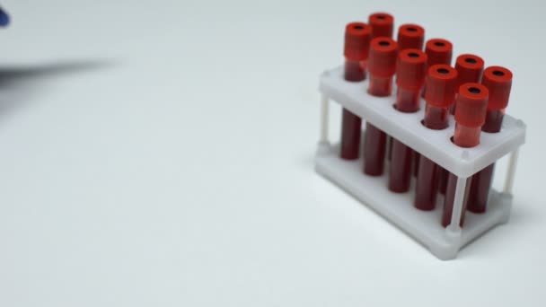Test positif de zinc, médecin montrant un échantillon de sang, recherche en laboratoire, bilan de santé — Video