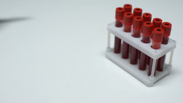 Teste de fósforo positivo, médico mostrando amostra de sangue em tubo, pesquisa de laboratório — Vídeo de Stock
