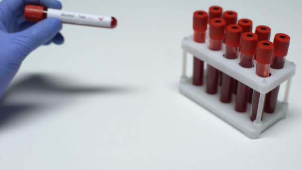 Positivt alkohol test, läkare visar blodprov, lab forskning, hälsokontroll — Stockvideo