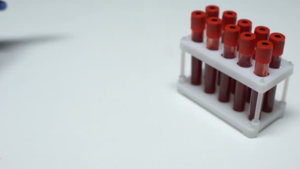 Teste de Mycoplasma positivo, médico mostrando amostra de sangue em tubo, exame de saúde — Vídeo de Stock