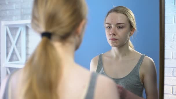 거울, 사춘기 피부 문제, 호르몬을 찾고 얼굴 여드름십대 여성 — 비디오