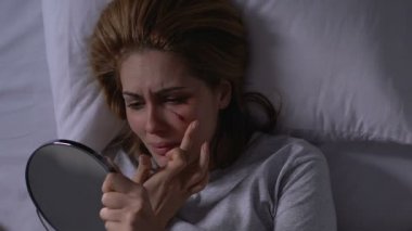 Kadınlar yaralı yüzlere krem sürüyor ve ağlıyor, şiddet mağduru.