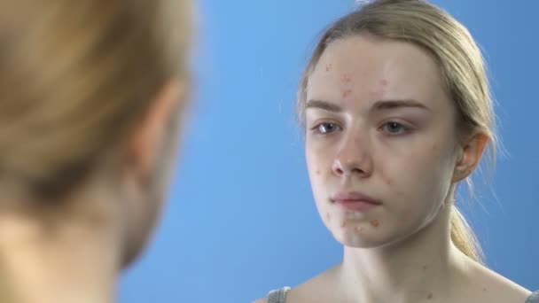 Teen girl with pimply face looking in mirror, dermatology problems in young age — Stock Video