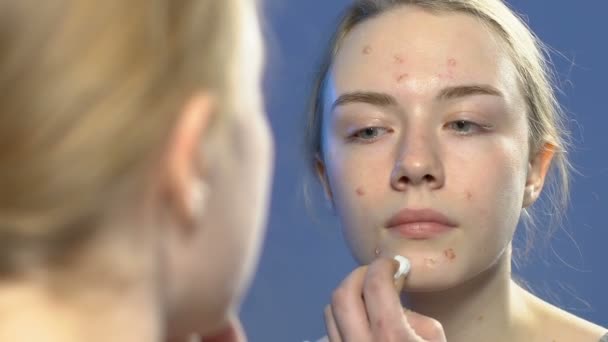 Female teenager applying cosmetic treatment on face pimples, anti-acne skin care — Stock Video