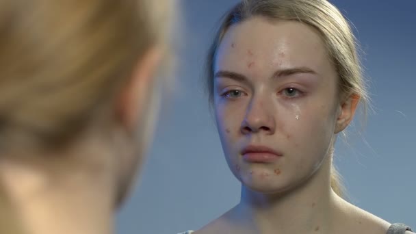 Плачущая юная леди с отвращением смотрит на лицо прыщей в зеркале, неловкий возраст — стоковое видео