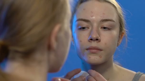 Vrouwelijke tiener knijpende acne, ongepaste huidverzorging, hormoon onbalans — Stockvideo
