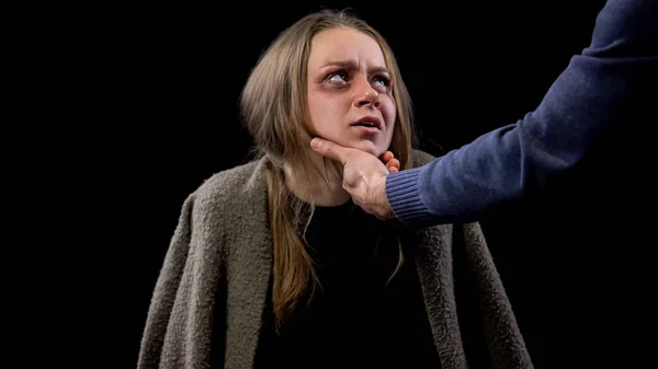 Hombre Mano Tomando Llorando Cara Femenina Con Moretones Violencia Doméstica — Foto de Stock