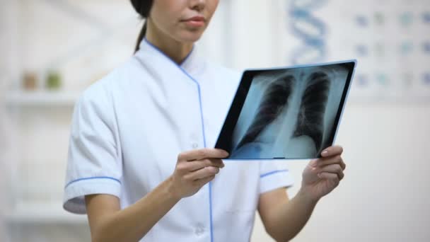 女性医師が肺X線写真を注意深く見て、気管支炎のリスク、健康 — ストック動画