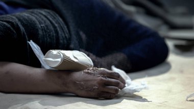 Kirli sokakta uyuyan, soğuktan koruyan deri yanıkları olan evsiz kişi