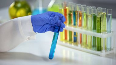 Madde yıkama tortu tüp mavi sıvı ile kontrol laboratuar asistanı