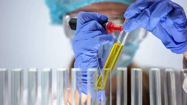 Laboratório Médico Tubo Marcação Com Amostra Urina Verificando Nível Bilirrubina — Fotografia de Stock