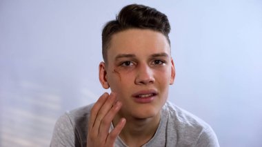 Yüzünde yara ile mutsuz genç dokunmadan ve kameraya bakarak, kavga