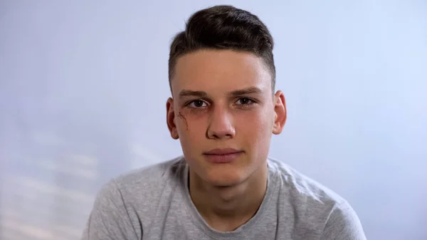心烦意乱的男性青少年与受伤的脸看着相机 攻击在家庭 — 图库照片