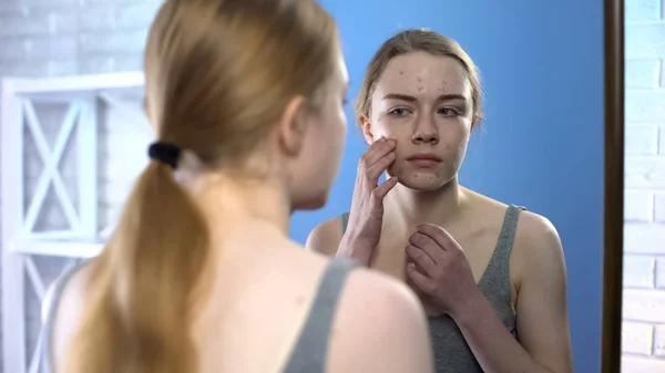 Olycklig Tonårs Flicka Med Ansikte Akne Ser Spegeln Hormonella Hudproblem — Stockfoto