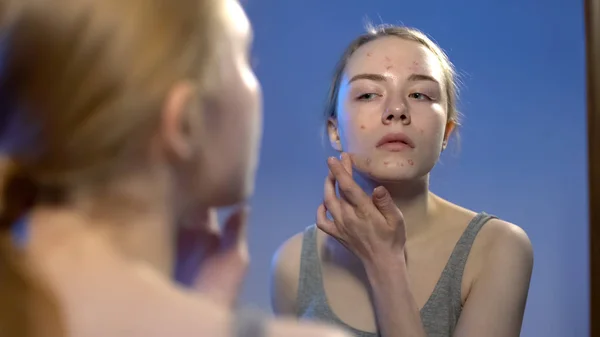 Chica Adolescente Mirando Espejo Aplicación Crema Facial Tratamiento Del Acné — Foto de Stock