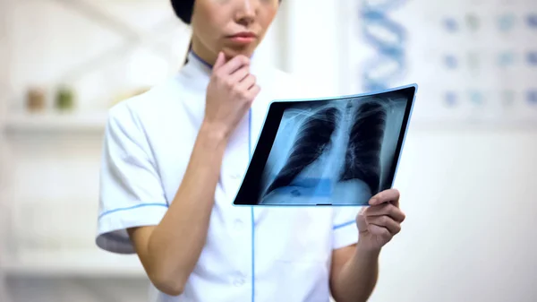Профессиональная Женщина Терапевт Смотрит Рентген Легких Думает Диагностике — стоковое фото