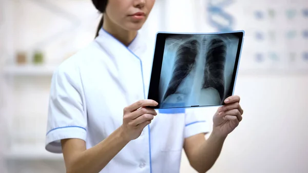 Médico Femenino Mirando Atentamente Radiografía Pulmones Riesgo Bronquitis Salud —  Fotos de Stock