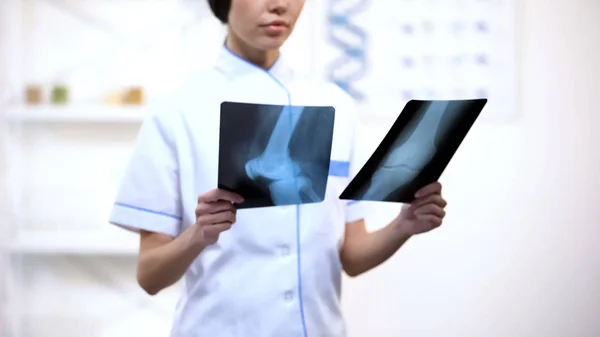 医生在统一检查骨骼X光创伤和康复期 — 图库照片
