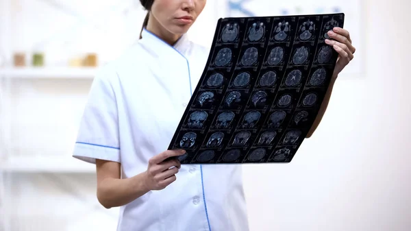 Neurocirurgião Experiente Olhando Para Raio Cérebro Chateado Com Resultado Exame — Fotografia de Stock