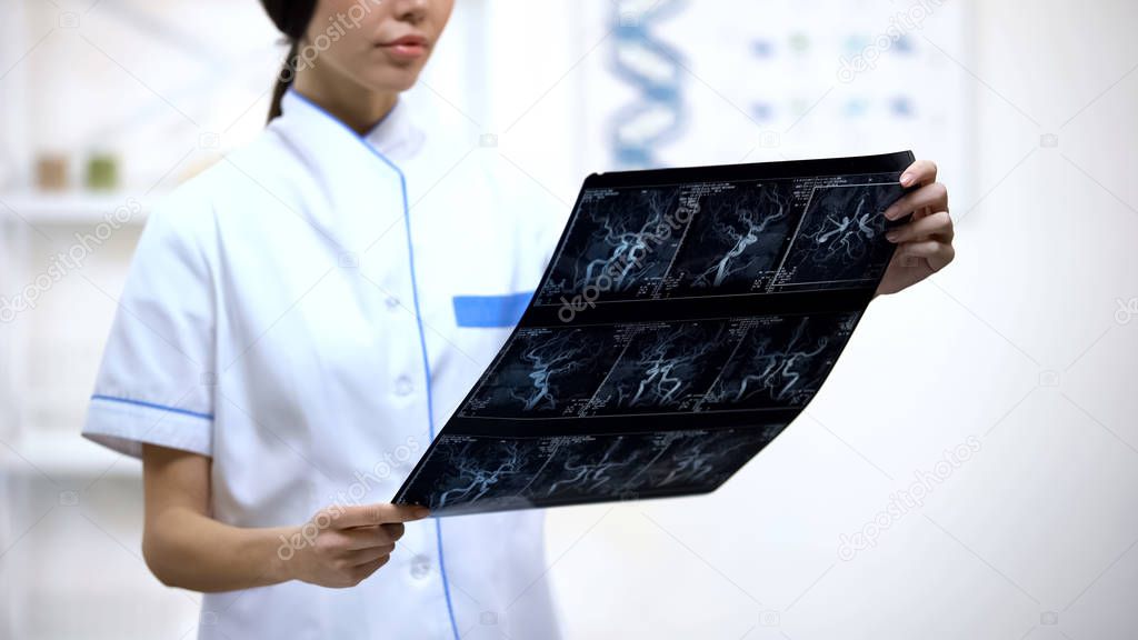 Attentive female neurosurgeon looking at brain vessels x-ray, analyzing results