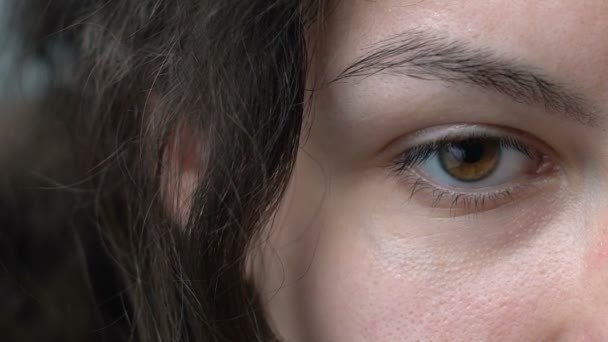 Fille avec paupière gonflée abaissant ses yeux, problèmes de santé, surmenage — Video