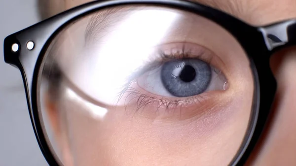 眼鏡をかけた子供のクローズアップ 小児眼疾患 眼科概念 — ストック写真