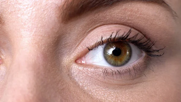 Nahaufnahme Des Weiblichen Auges Leiden Unter Trockenen Augen Syndrom Sehstörungen — Stockfoto