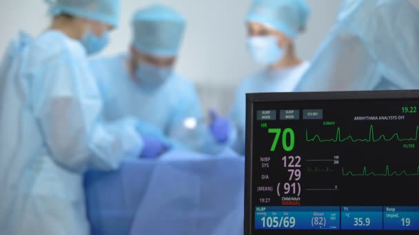 Ecg monitorare l'attività di registrazione della frequenza cardiaca durante l'operazione ospedaliera, chirurgia — Video Stock