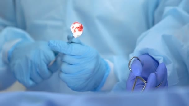 Врачи, работающие вместе с помощью инструментов, трансплантации органов — стоковое видео