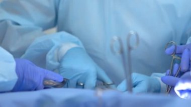 Ameliyat doktoru ameliyat tepsisinde organ parçası koyarak tümör rezeksiyon, histoloji