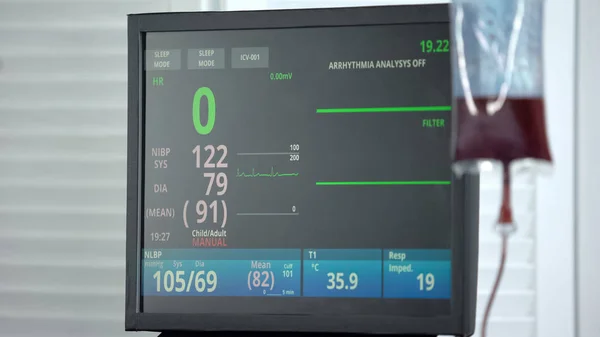 Frequenza Cardiaca Zero Sul Monitor Ecg Nella Sala Rianimazione Trasfusione — Foto Stock