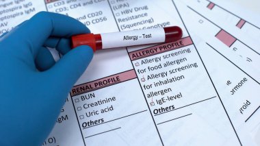 Alerji, doktor tüpte kan örneği gösteriyor. Laboratuvar sonuçları temiz.
