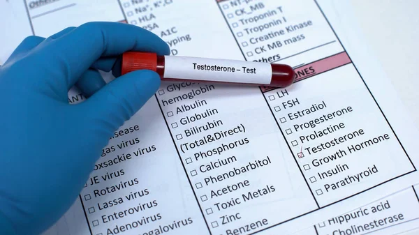 Testosterone, doctor showing blood sample in tube, lab research, health checkup