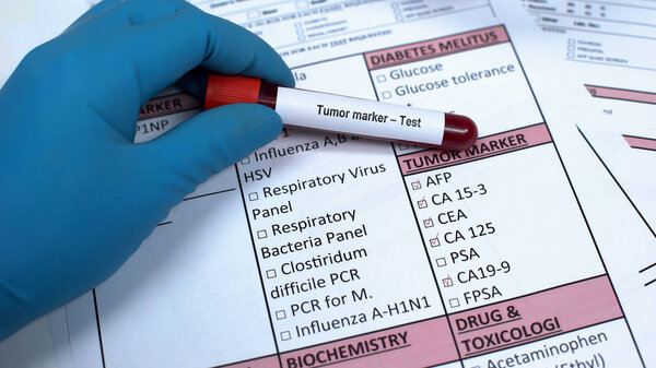 Tumor marker, doctor showing blood sample in tube, lab research, health checkup