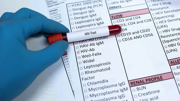 Hiv Viruslast Arzt Zeigt Blutprobe Röhre Laboruntersuchung Gesundheitsprüfung — Stockfoto