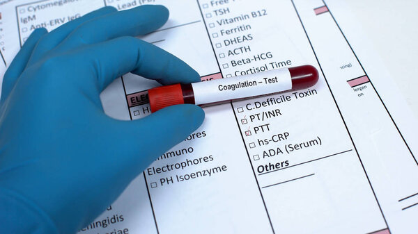Coagulation, doctor showing blood sample in tube, lab research, health checkup