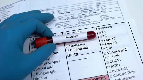 Positive Hemophilia Test Doctor Showing Blood Sample Tube Health Checkup — Stock Photo, Image