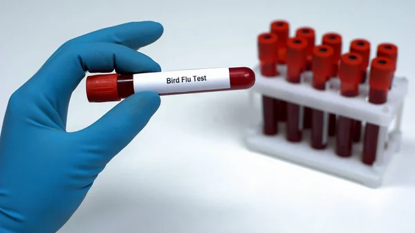 Vogelgrippe Test Arzt Zeigt Blutprobe Röhrchen Laboruntersuchung — Stockfoto