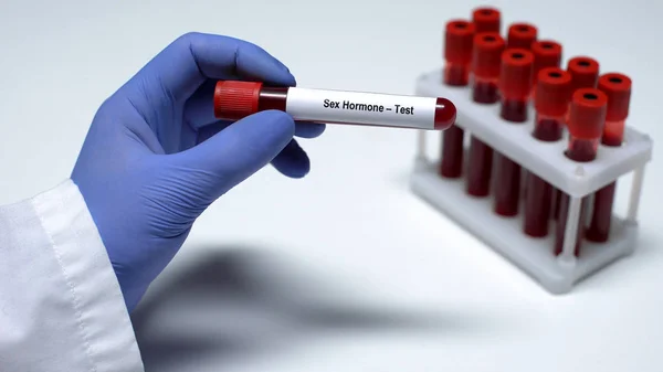 Sexualhormon Arzt Zeigt Blutprobe Schlauch Laboruntersuchung Gesundheitsprüfung — Stockfoto