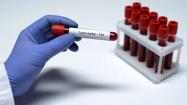Маркер Пухлини Лікар Показує Зразки Крові Трубці Лабораторні Дослідження Огляд — стокове фото