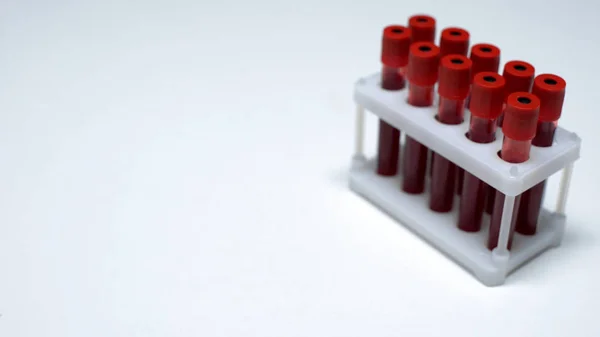 Tabung Tes Dengan Sampel Darah Meja Pemeriksaan Laboratorium Layanan Kesehatan — Stok Foto