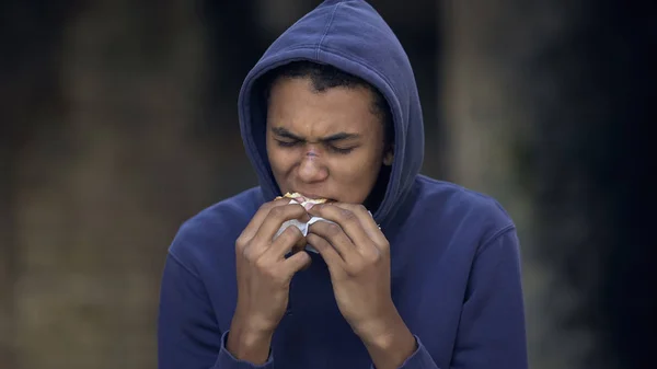 Μαύρος Νεαρός Ουλή Στο Πρόσωπο Τρώει Σνακ Δρόμο Προβληματισμένος Έφηβος — Φωτογραφία Αρχείου